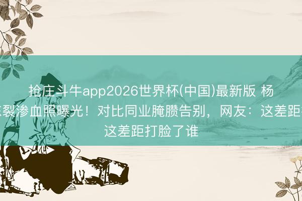 抢庄斗牛app2026世界杯(中国)最新版 杨紫手背冻裂渗血照曝光！对比同业腌臜告别，网友：这差距打脸了谁